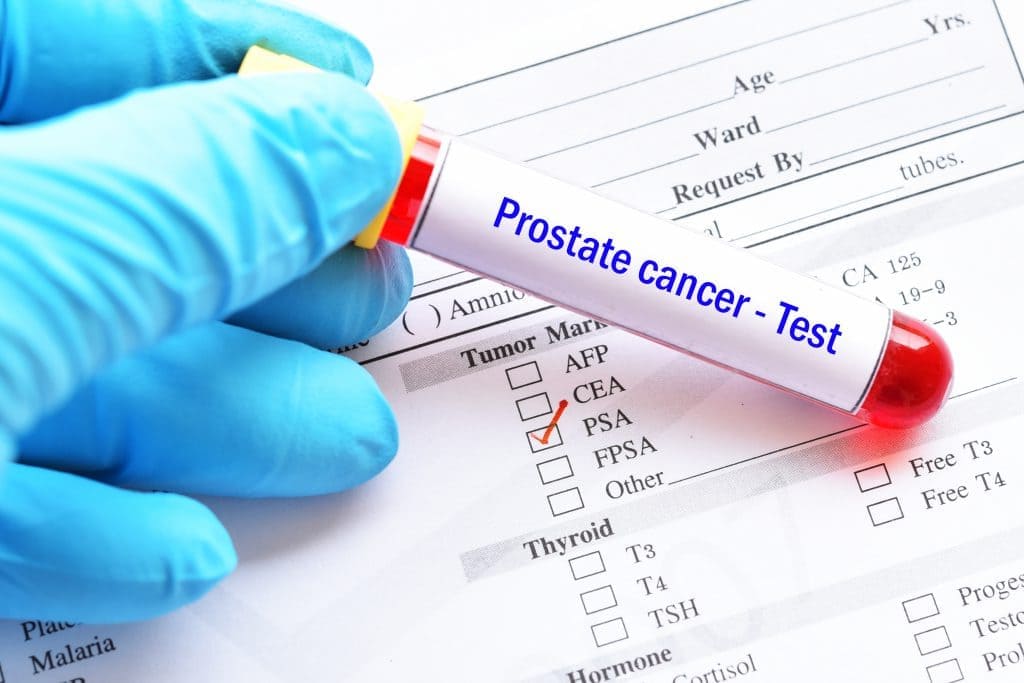 cancer test